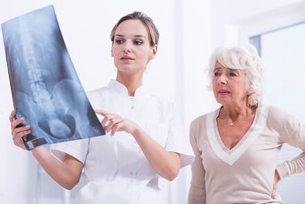 O médico móstrase ao paciente unha imaxe x -ray da columna vertebral