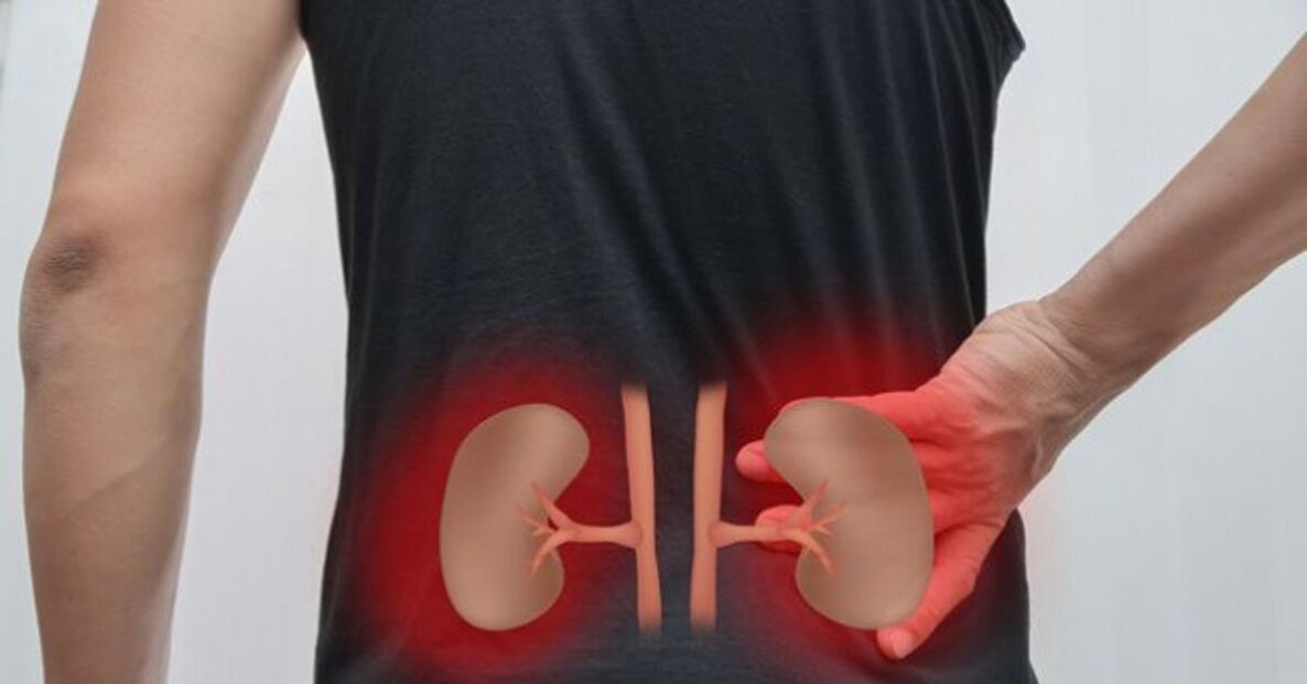 enfermidade renal como causa da dor lumbar
