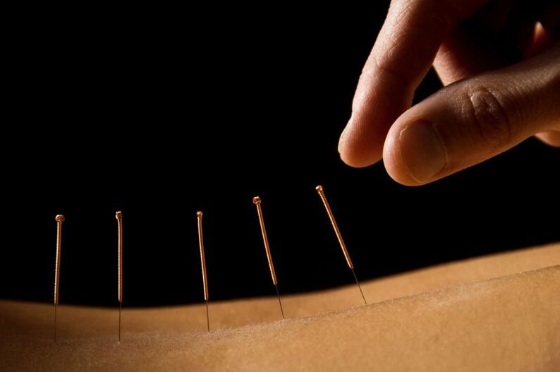 acupuntura para a dor lumbar