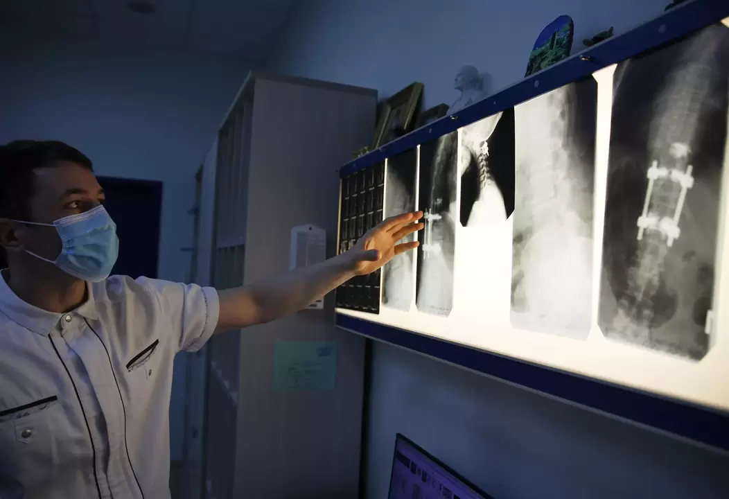 Os médicos diagnostican a osteocondrose cervical mediante métodos instrumentais, como a radiografía